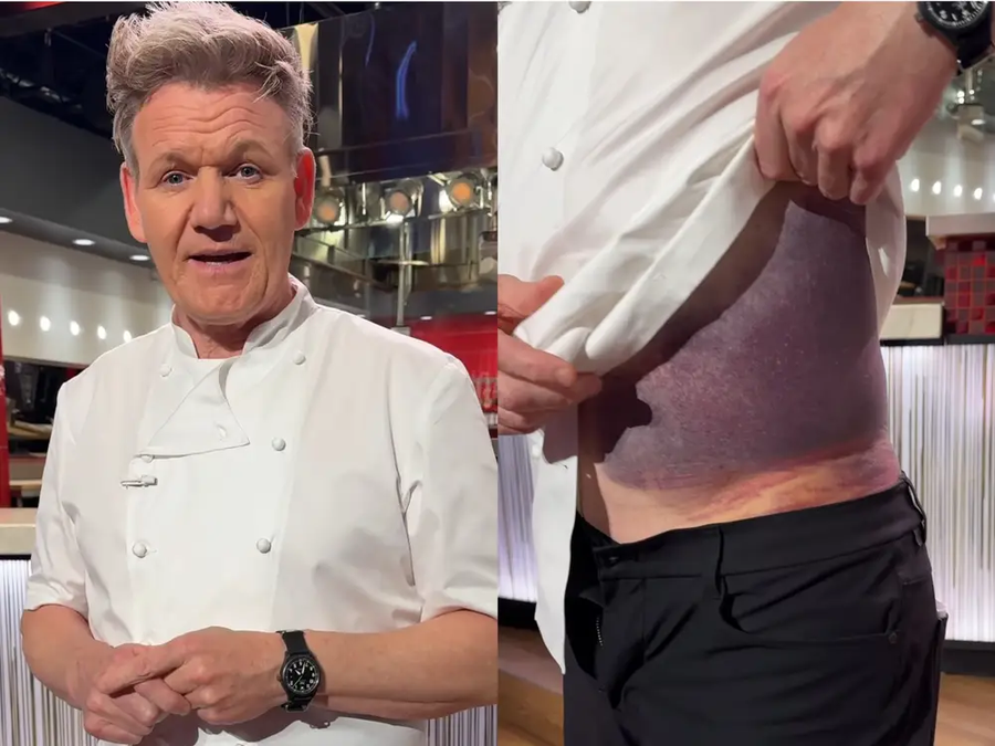 “Nuk do të isha këtu”, Gordon Ramsay i mbijeton aksidentit të rëndë